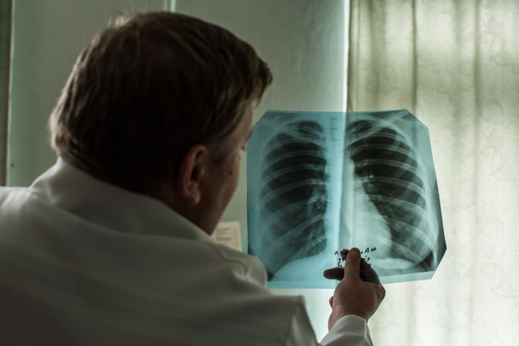 Tuberculosis: Una Enfermedad Presente En La Región