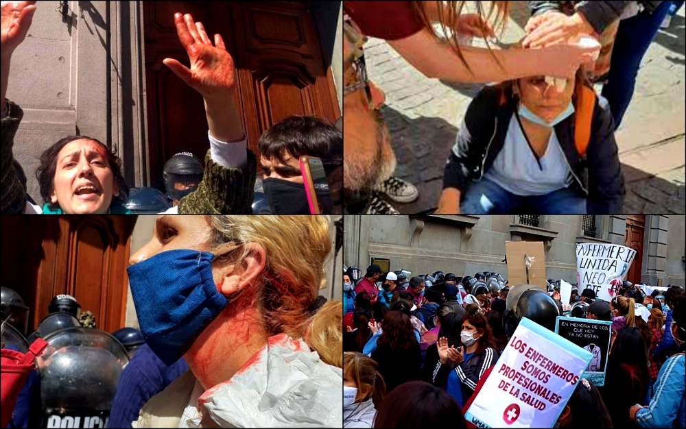 Represión Del Gobierno Porteño A Enfermeras Y Enfermeros: “Siempre Es Grave, Pero En Medio De Una Pandemia, Es Absolutamente Repudiable”